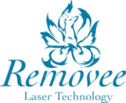 Removee Laser