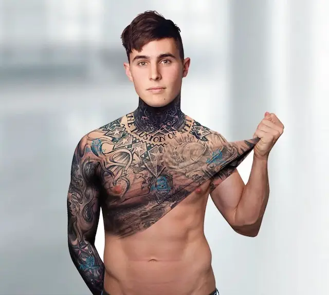 Remoção de Tatuagem, Remoção de Tatuagem a Laser