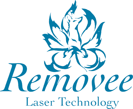 Removee Laser